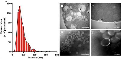 Extracellular Vesicles Derived From Talaromyces marneffei Yeasts Mediate Inflammatory Response in Macrophage Cells by Bioactive <mark class="highlighted">Protein Components</mark>